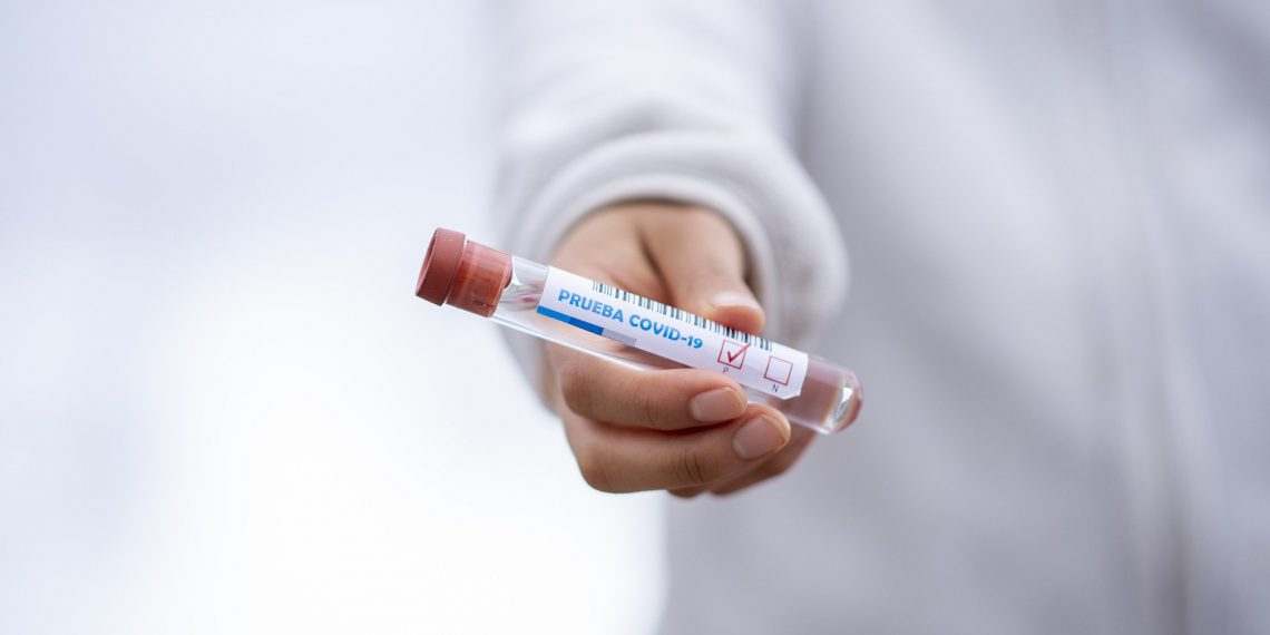 Nu skal der testes systematisk for COVID-19
