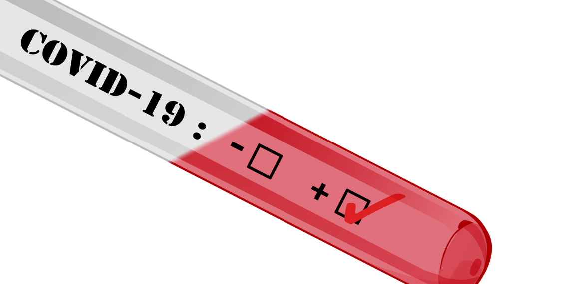 Regionen om COVID19-test af personale – vi er presset på testkits