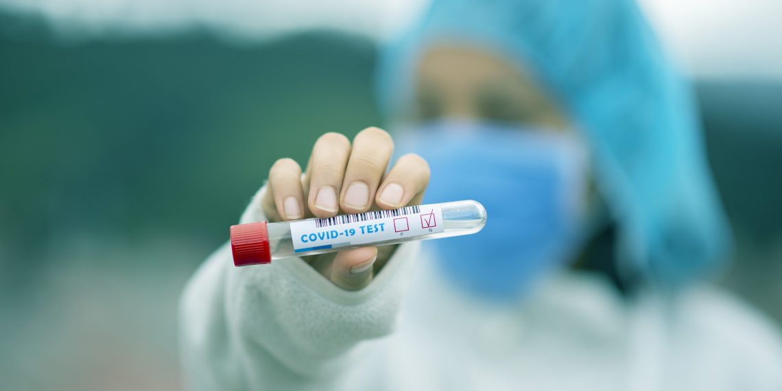 Få tid til coronatest i Jammerbugt Kommune